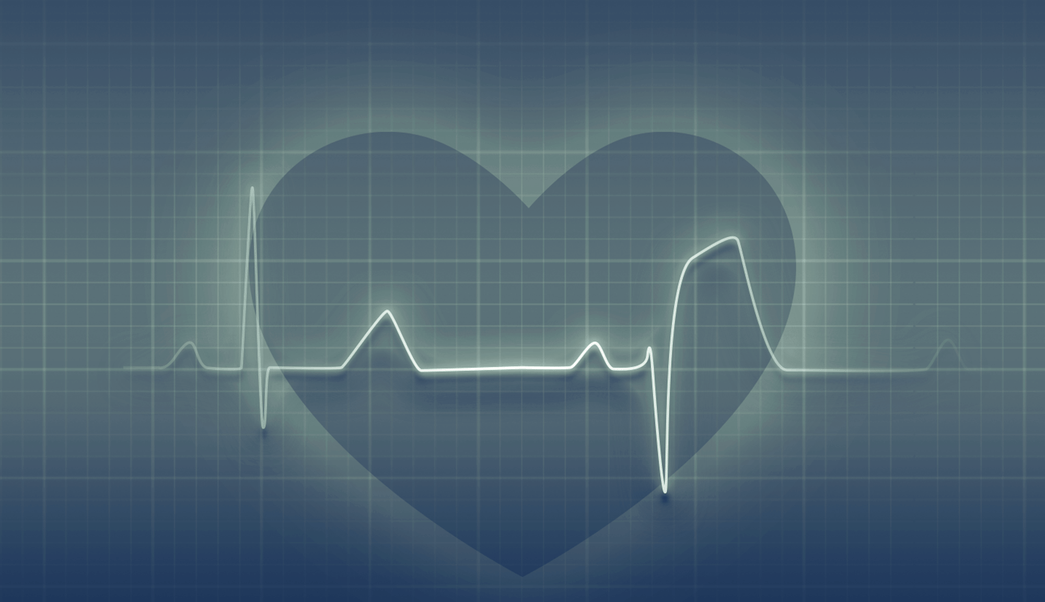 ¿Cómo identificar un infarto al corazón y cómo prevenirlo?